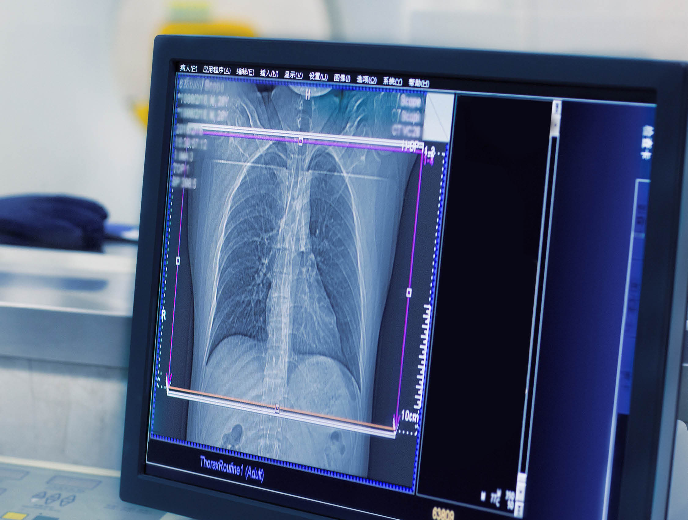Hospital CT Scanner
