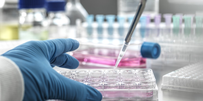 Scientist pipetting medical samples into microplate in a laboratory